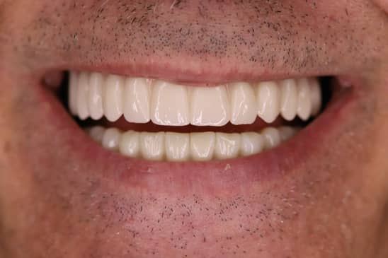 Slider image (7) Dentech Dental Centar